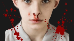 Anak 15 Tahun Sering Mimisan Usai Dianiaya Oknum Polisi