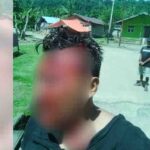 Akibat Dikeroyok Masa Desa Yaba, Dua Anggota Polri Alami Luka Sobek